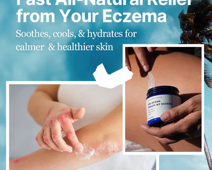 Eczema Soothing Cream – Organic, Hydrating & Fragrance-Free